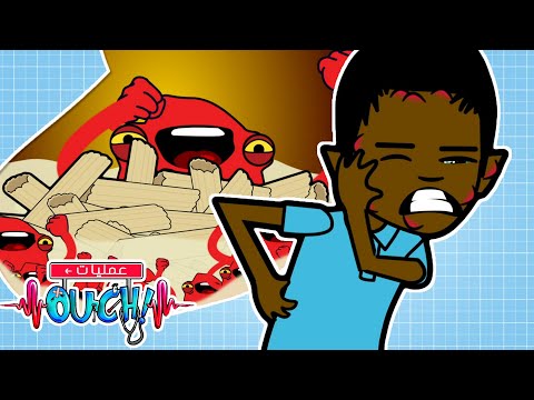 عمليات أوتش ما هي الحساسية حلقات كاملة