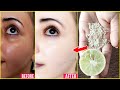 2 मिनट इसे लगालो चेहरा बेहद गोरा टाइट और खुबसुरत बना देगा | Gora Hone Ka Tarika /Skin Whitening