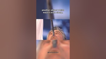 Strangest ways people have died… (Part 3) #shorts #youtubeshorts