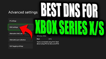 Best DNS Server For Xbox Series X/S (Faster internet for FREE by changing this one setting!)