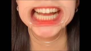 美女大学生口腔检查蛀牙烂牙扁桃体检查了解更多口腔检查Q507871282