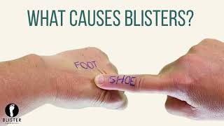 What Causes Blisters On Feet? screenshot 5