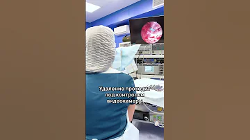 Как проходит гистероскопия? Удаление полипа в матке.