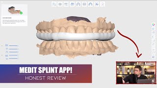MEDIT: Splint App | Diseño CAD Dental mediante Inteligencia Artificial screenshot 4