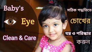 How To Clean & Care Baby's Eye | সঠিক ভাবে চোখের যত্ন ও পরিস্কার করুন না হলে হতে পারে ক্ষতি