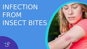 Skin Infection From Bug Bites - Daily Do's of Dermatology