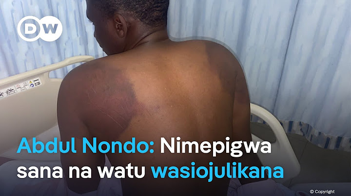 Nondo anazungumzia kutekwa kwake
