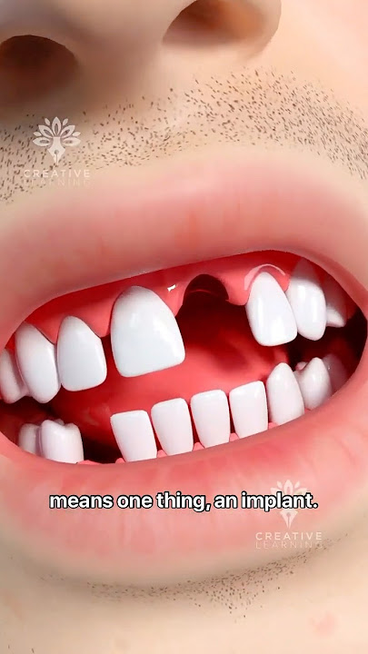 Can You Really Regrow Teeth?  Japan’s New Drug Explained! #short -Creativelearning3d