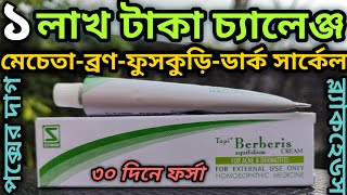 30 দিনে ফর্সা হবেন 😘 | ব্রণ, মেচেতা, ব্ল্যাকহেডস, চোখের তলায় কালো দাগ, পক্সের দাগ দূর করার উপায় | screenshot 2