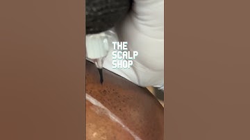 Needle Depth: #scalpmicropigmentation VS #tattoo Can You Guess?