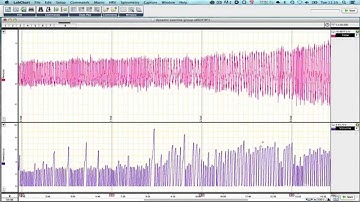 AD Instruments LabChart Spirometry Pod calibration and Drift