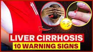 Liver Cirrhosis- 10 Warning Signs You Should Never Ignore by Health Apta 452 views 4 days ago 8 minutes, 10 seconds