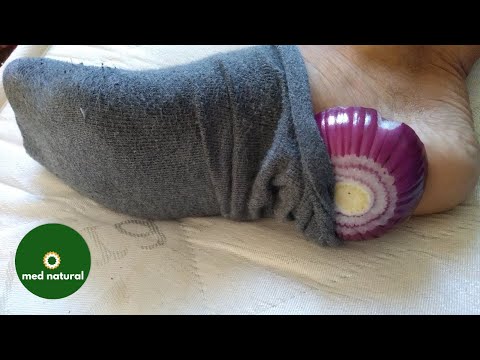 Що відбувається, коли ви спите з цибулею в шкарпетках?