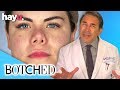 Woman Wants To Fix Her 'Pig Nose'! | Season 6 | Botched