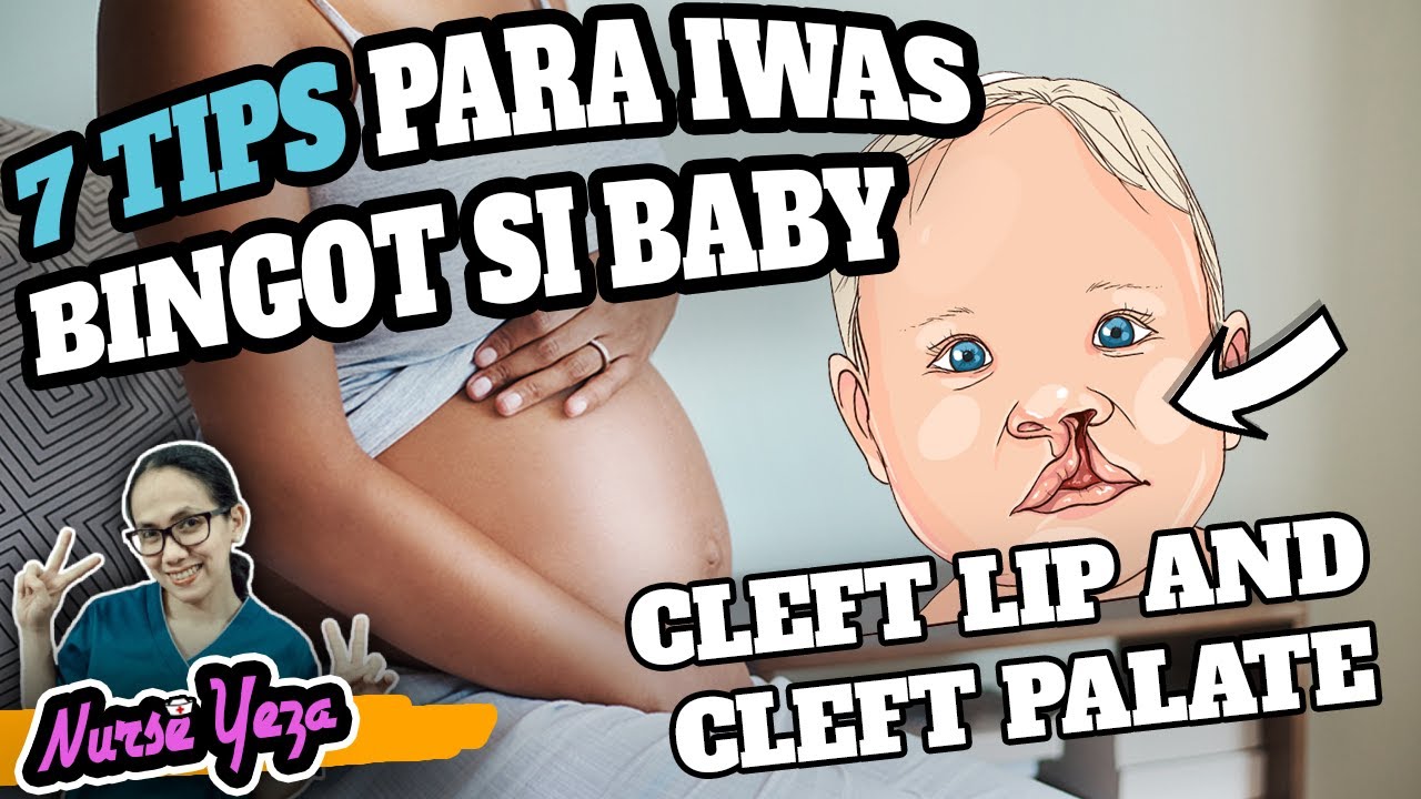 BAKIT NAGKA BINGOT SI BABY?