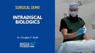 Intradiscal Biologics - Douglas P. Beall M.D.