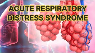 Acute Respiratory Distress Syndrome (ARDS) (updated 2023) - CRASH! Medical Review Series