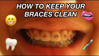 HOW TO CLEAN YOUR BRACES