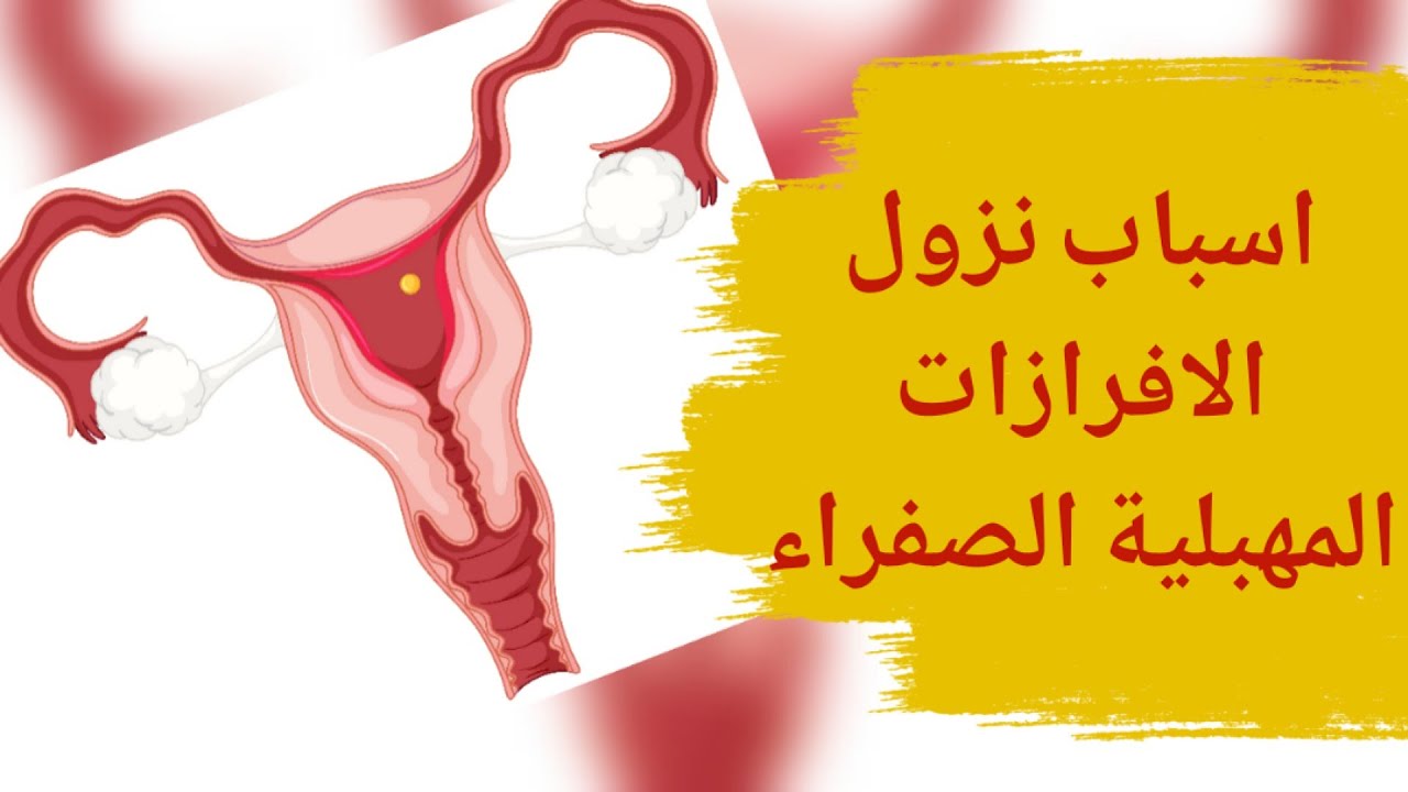 افرازات صفراء من المهبل | افرازات صفراء من المهبل بدون رائحة | اسباب نزول  إفرازات صفراء - YouTube