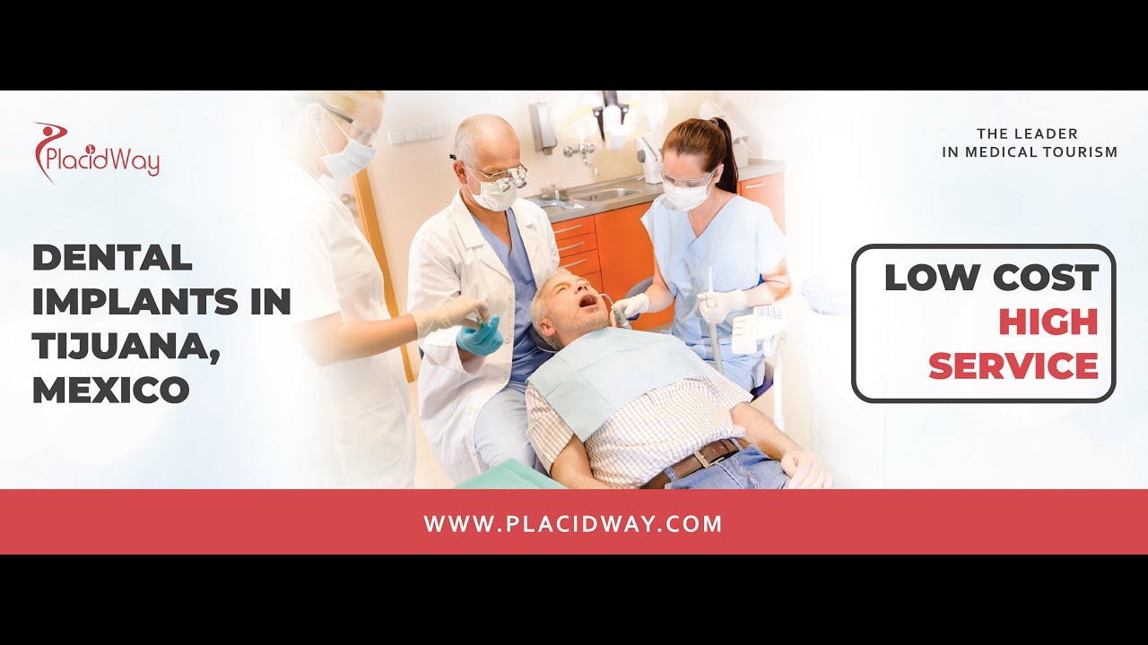 All on 4 Dental Implants in Tijuana - Your Best Dental Care in Mexico