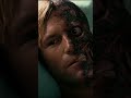 The Dark Knight 2008 Harvey Dent Showing His Two Face After Accident Film Movie Darkknighttrilogy mp3