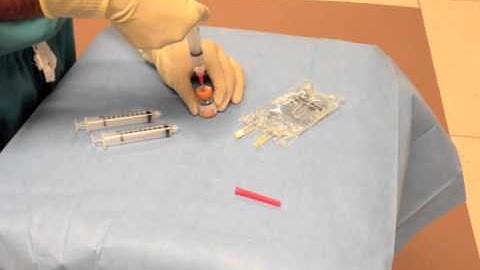 Intradetrusor onabotulinumtoxinA injection