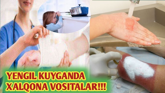 Katta xoroz transseksuallar video jinsiy aloqa