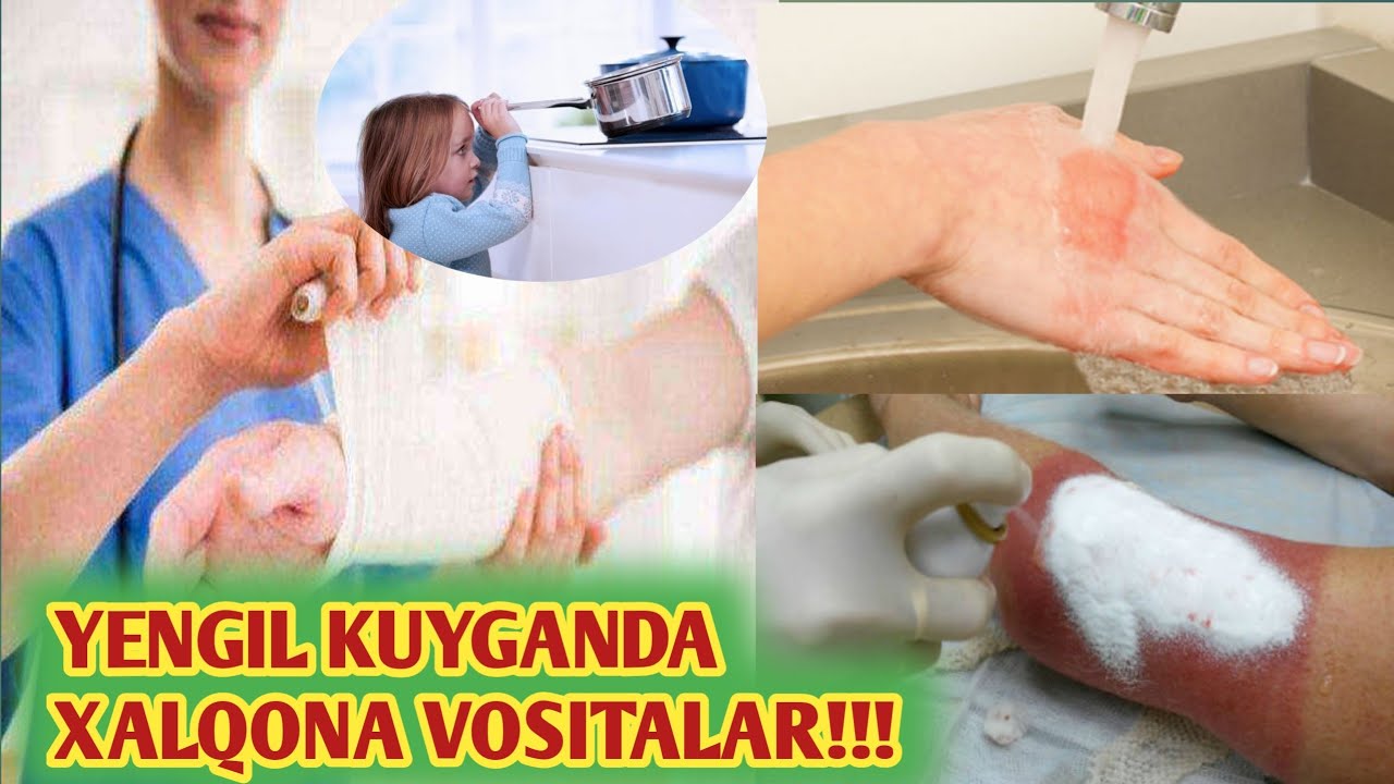 Sobiq qiz dostlarining fotosuratlari Shved etuk ayollar porno rasmlar