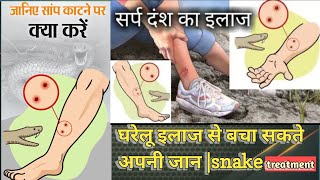 सांप?(snake)काट ले तो तुरंत करें यह काम बच जाएगी आपकी जान | यह सावधानियां बरतने से बच जायेगी जान