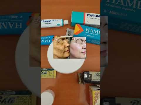 اقوى خلطة تقشير الوجه يرجعك وكالة