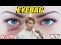 EYE BAGS Removal Exercise + Prevent puffy eye massage 預防去除眼袋按摩 | ISSAC YIU