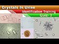 Crystals in urine identification training quiz  part 35 