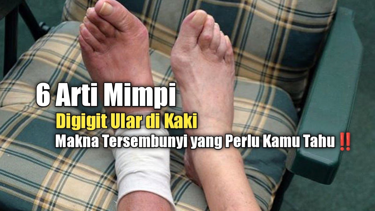 6 Meanings of Dreams About Being Bitten by a Snake on the Leg: Hidden Meanings You Need to Know!