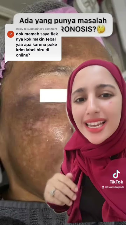 Flek makin tebal?Awas okronosis! #skincaretips #skincareroutine #flekhitam #dokter #dokterkecantikan
