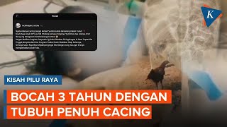 Raya, Kisah Tragis Bocah di Sukabumi Meninggal dengan Tubuh Dipenuhi Cacing