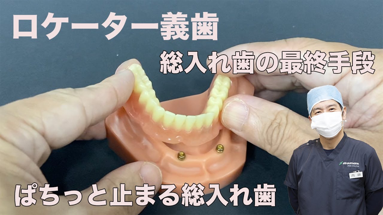 locator denture - YouTube