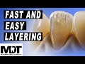 Discover the Fast and Easy e.max and Zirconia micro layering method [ Quick And Great Results ]