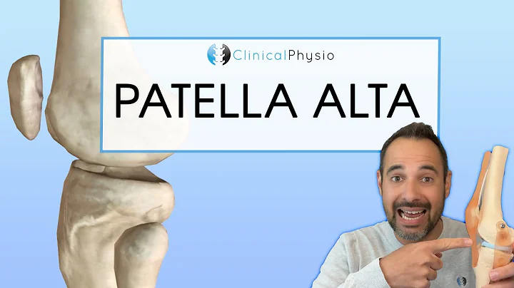 Patella Alta | Expert explains Diagnosis, Assessme...