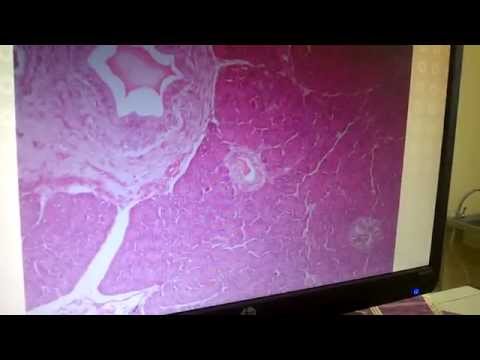 Video TỤY - THỰC HÀNH MÔ PHÔI - KHOA Y ĐẠI HỌC TÂY NGUYÊN - youtube