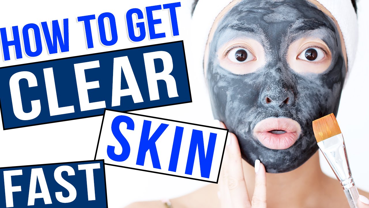 HOW TO Get Clear Skin FAST! YouTube