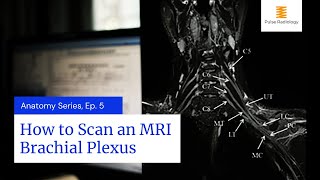 How to Scan an MRI Brachial Plexus