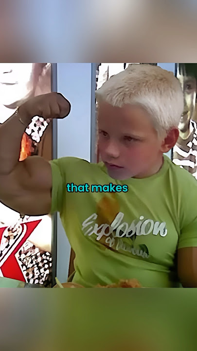 Growing Muscles As A Kid - The Case Of A Rare Mutation