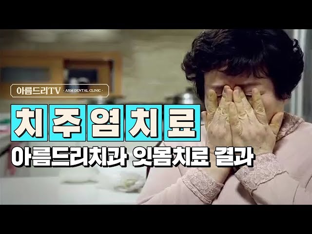 [채널A] 특별기획 - 주름을 보면 건강이 보인다. 치주질환(잇몸병) 치료 | 강남 아름드리치과