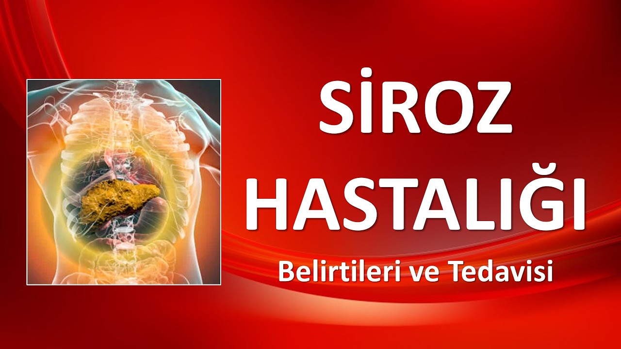 SİROZ HASTALIĞI Belirtileri ve Tedavisi