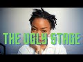 The Ugly Stage | How to Deal with the Ugly Stage of Locs