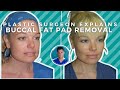 BUCCAL FAT PAD REMOVAL: Surgery, Recovery, Before and After