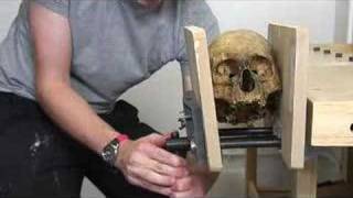 Human Skull Crushing