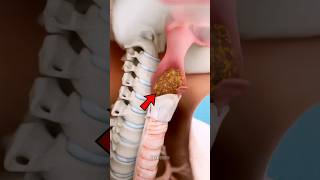 What Happens If We Swallow Pen Cap