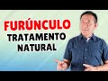 FURÚNCULO -TRATAMENTO NATURAL | Peter Liu