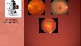 Comprehensive Eye Exam